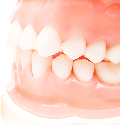 当院の入れ歯の特徴